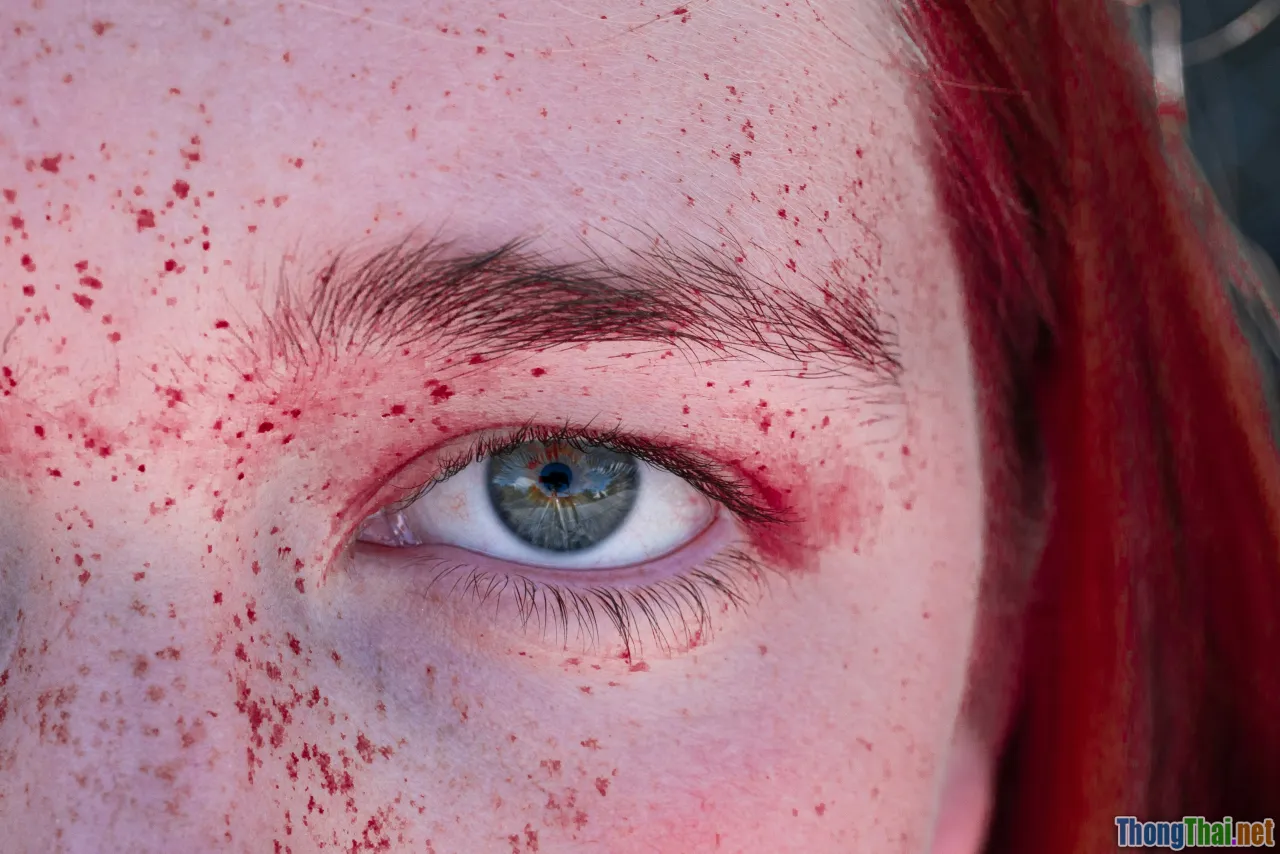 acne purge, irritation, AHAs, timeline