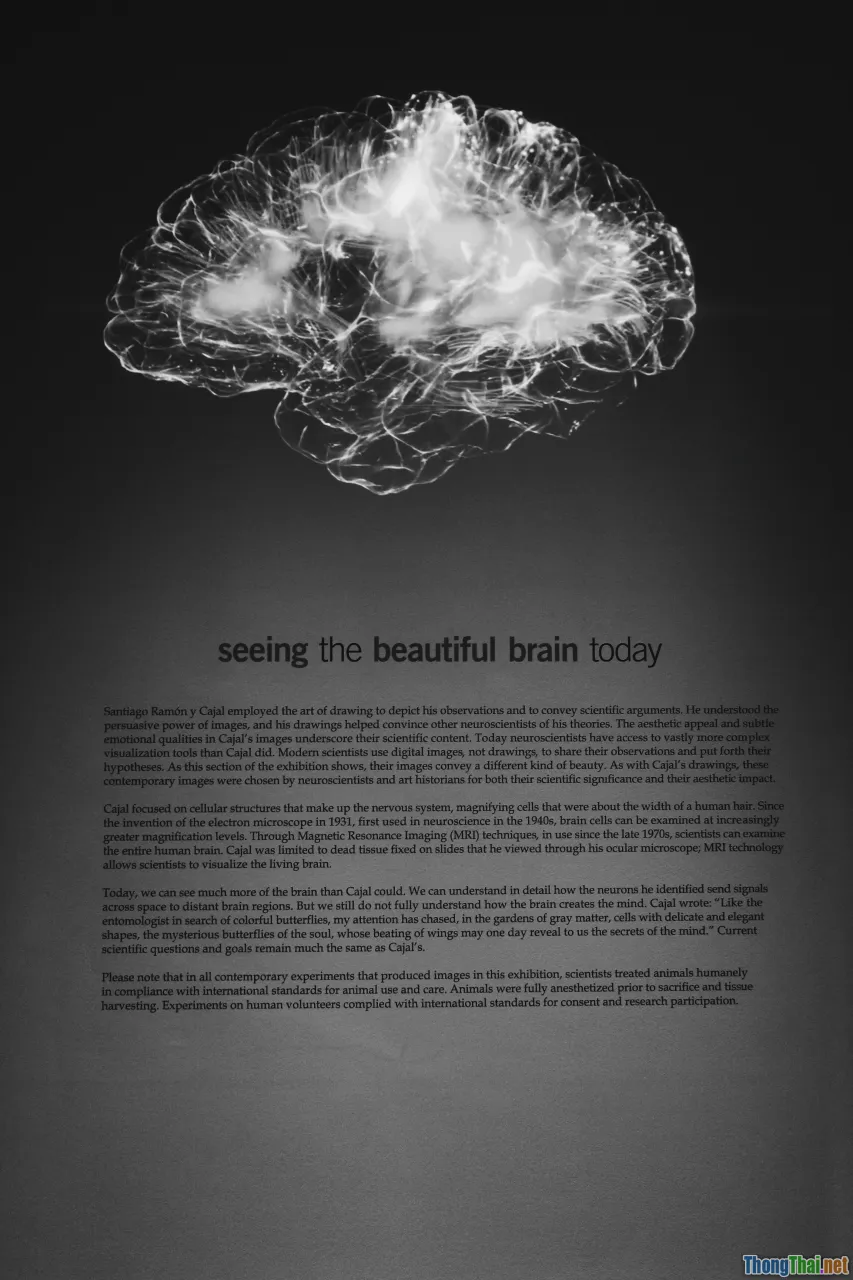 anxiety, ketosis, brain fog