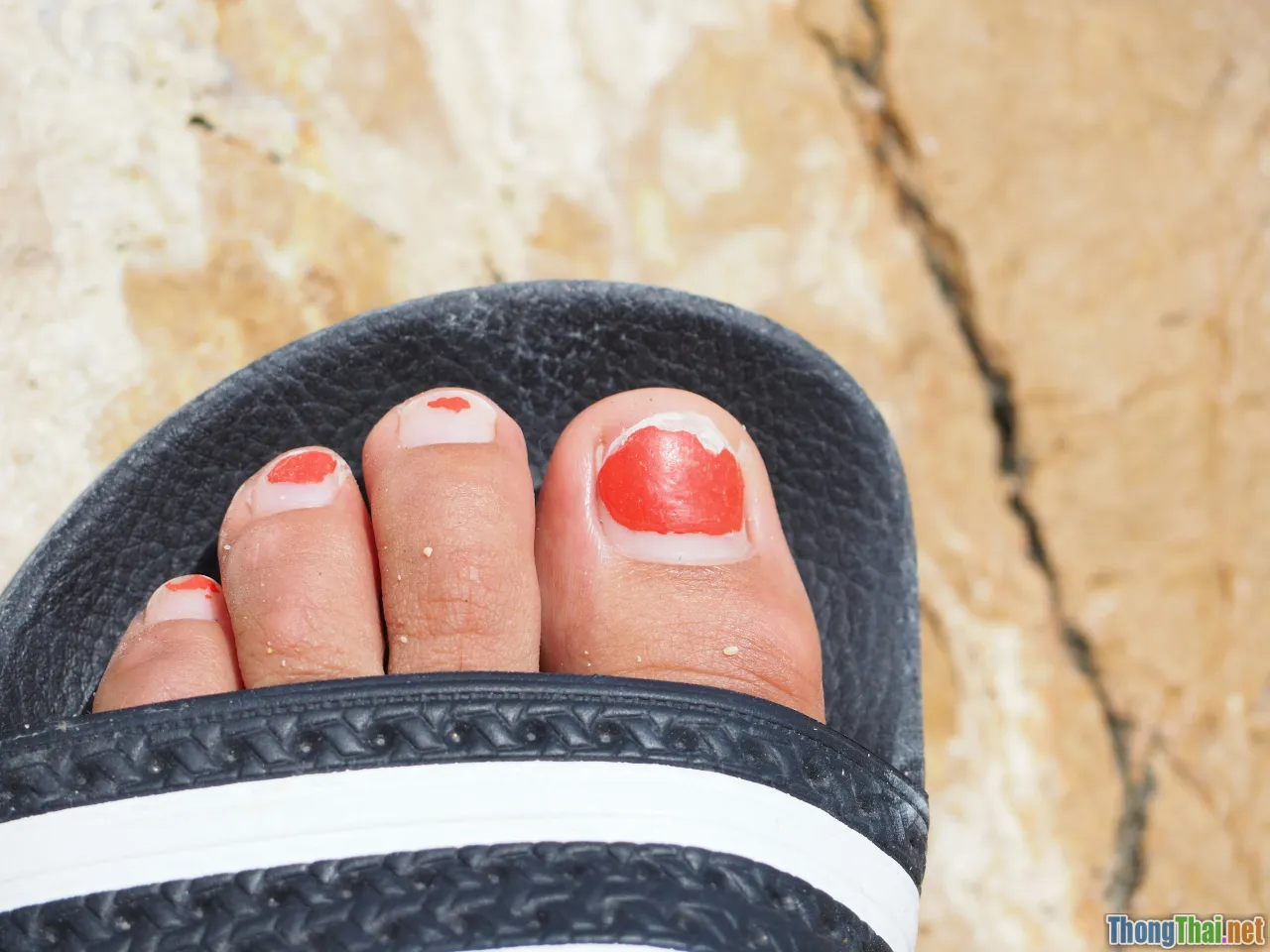 old toenail care myths
