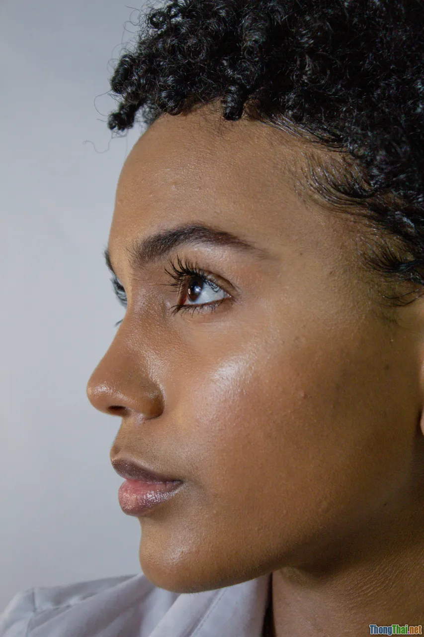 scalp discoloration, white patches, skin spots