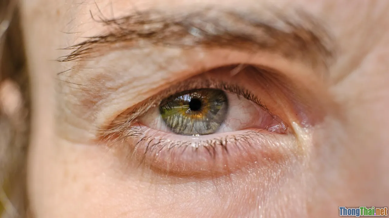 eye drops, blinking, warm compress