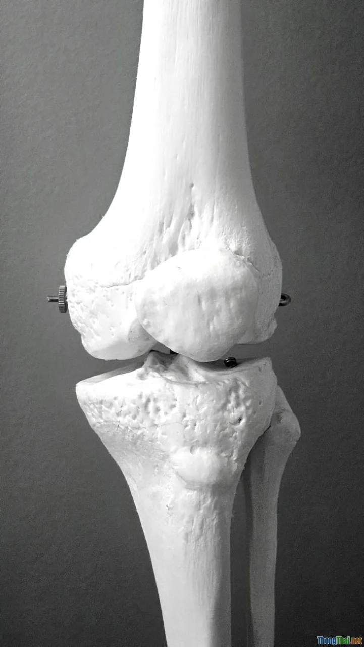 osteoporosis, bone structure