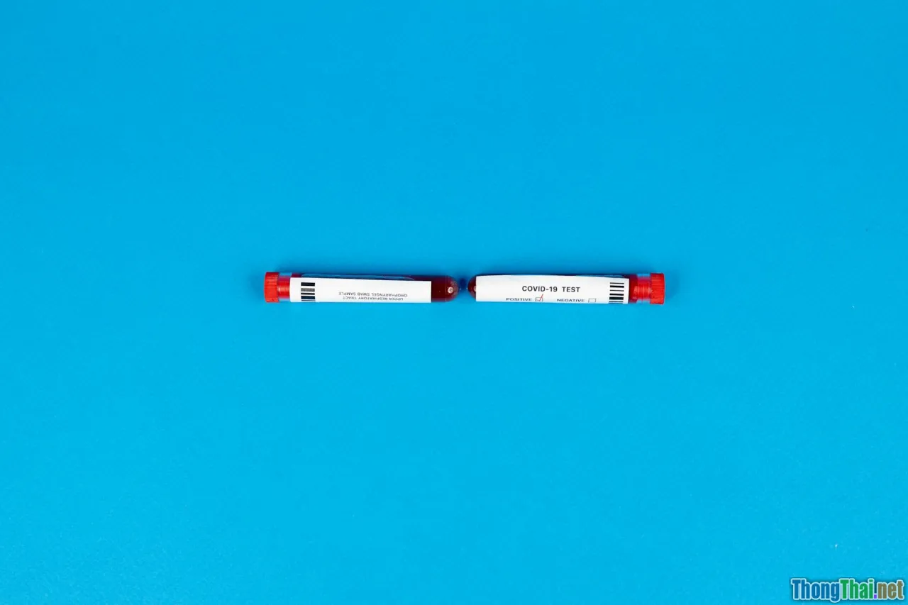 parallel tests, isolation, flakiness