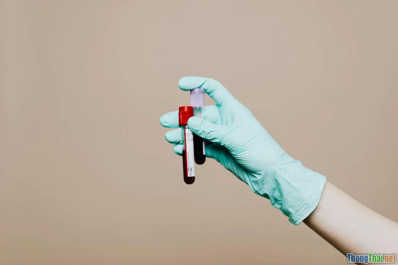 5 sai lầm phổ biến khi đọc kết quả xét nghiệm máu bạn cần tránh