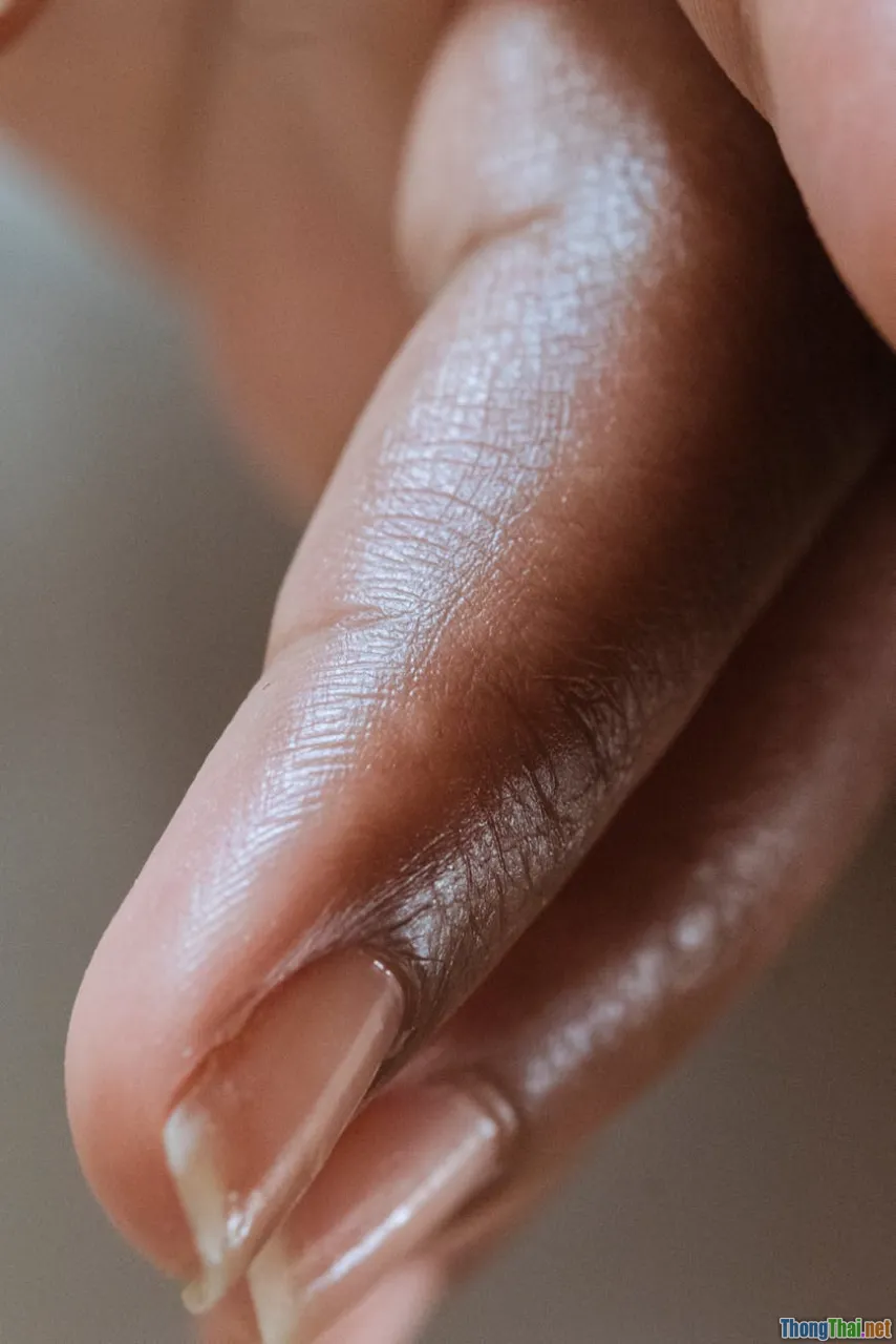 Bạn có đang chăm sóc móng sai cách Lời cảnh báo từ chuyên gia da liễu