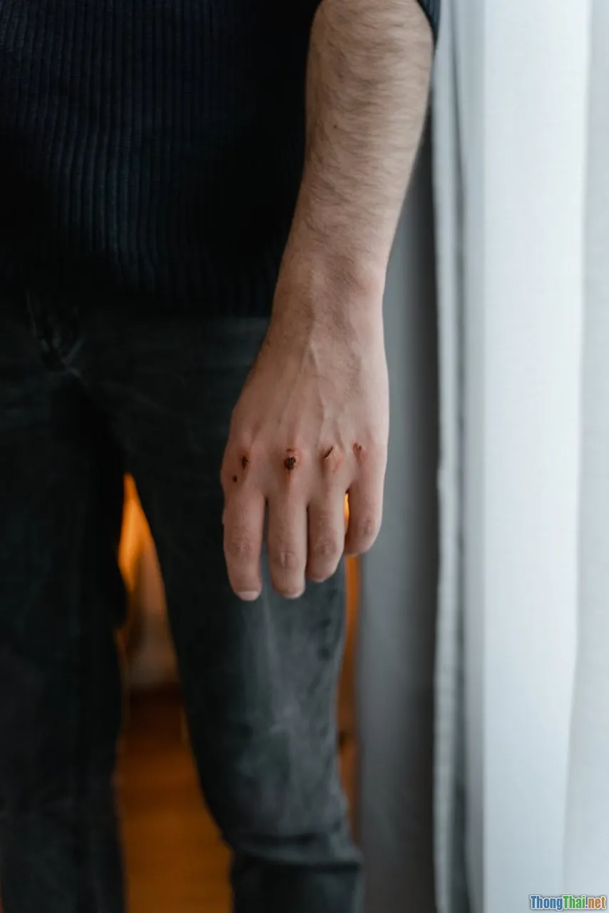 Có nên sơ cứu vết cắt bằng cồn Tranh cãi giữa truyền thống và khoa học