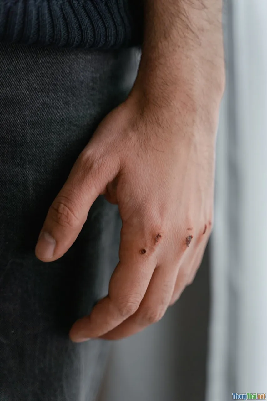 Tai nạn giao thông: Khi nào nên di chuyển nạn nhân để tránh tổn thương