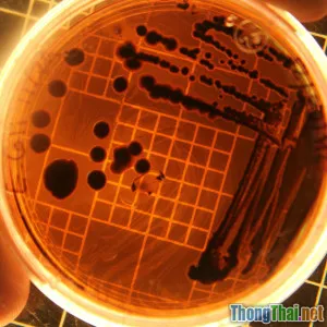 Làm thế nào để bắt đầu nghiên cứu sinh học tế bào