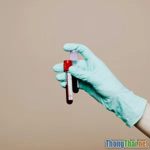 5 sai lầm phổ biến khi đọc kết quả xét nghiệm máu bạn cần tránh