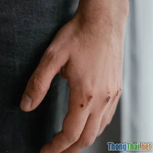 Tai nạn giao thông: Khi nào nên di chuyển nạn nhân để tránh tổn thương