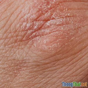 Top 5 dầu xả phục hồi tóc xơ khô 2024